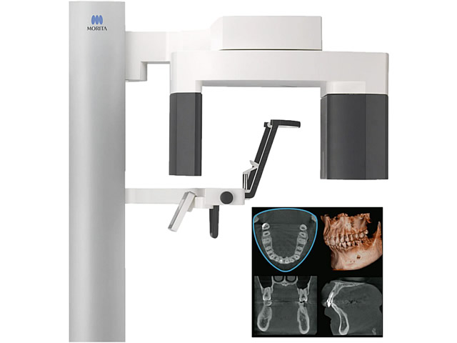 放射線量を軽減したデジタルＸ線・CT装置