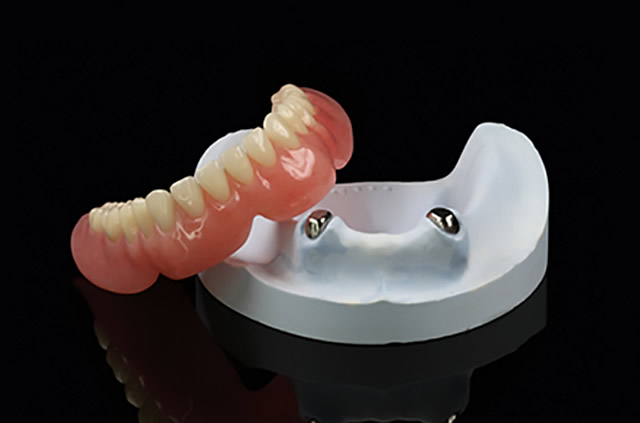 マグネットデンチャー