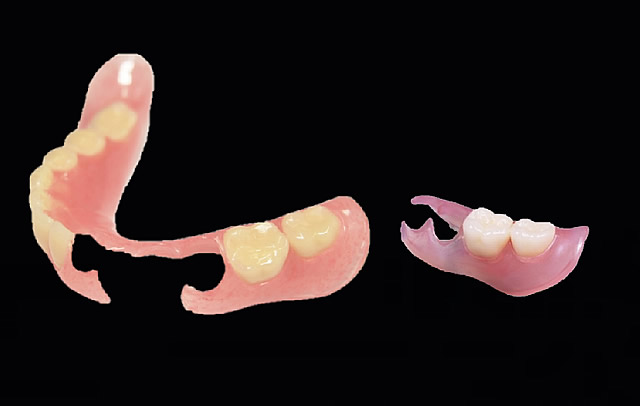 スマートデンチャー