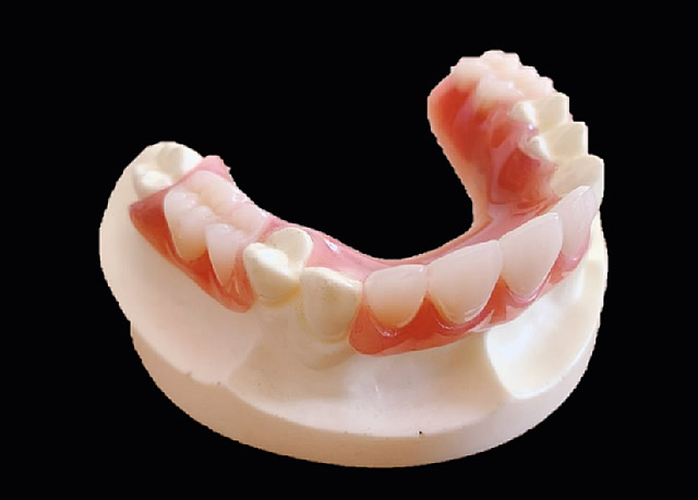 ミリングデンチャー