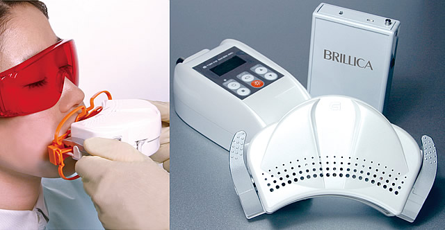 オフィスホワイトニング