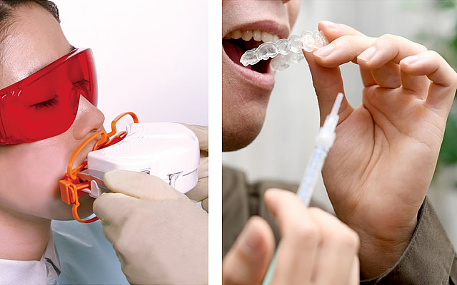 デュアルホワイトニング